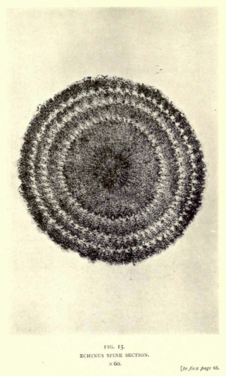 Illustration for article titled 110 Years Ago, These Microscopic Photos Horrified Londoners